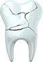 Illustration showing a cracked tooth